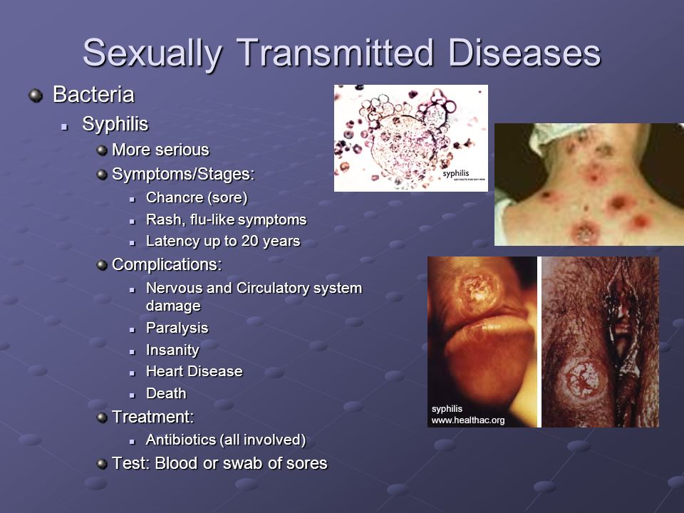 Sexual transmitted diseases from oral sex
